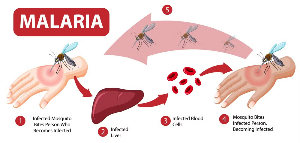malaria  - symptoms and prevention