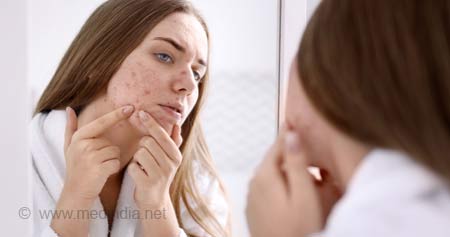 Symptoms of high testosterone in females