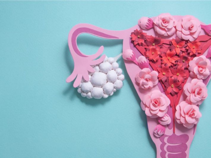 تكيس المبايض