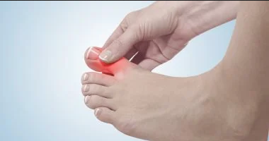 اليوريك اسيد كيف تتخلص منه