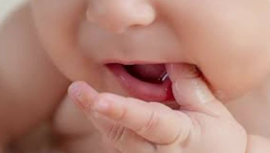 التسنين بين الحقيقة والشائعات 